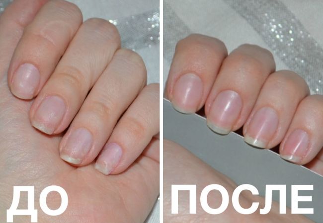 10 шагов к идеальному уходу за ногтями на ногах