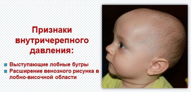 Внутричерепное давление у ребенка: симптомы и признаки внутричерепной гипертензии, как проверить и измерить, что делать при повышенном значении, лечение