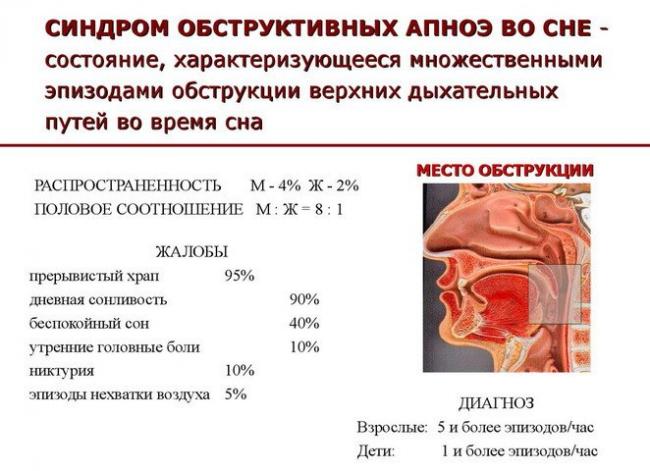 Апноэ — временная остановка дыхания во сне, при которой можно не проснуться