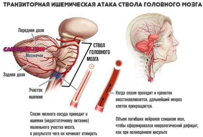 Онемение левой части головы и лица причины