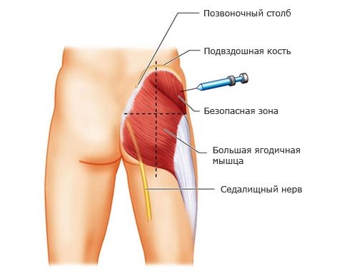 Артрадол мазь