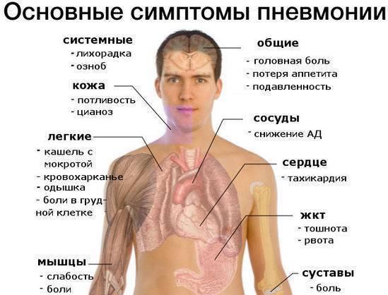Пневмония у лежачих больных: причины, симптомы, лечение