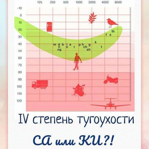 Инвалидность по слуху: критерии в 2020 году, как оформить