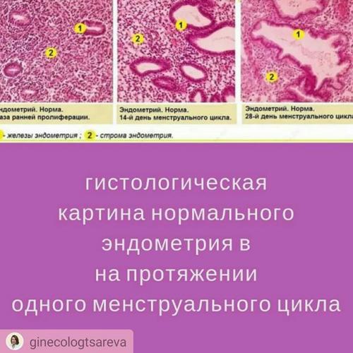 Гиперплазия эндометрия. виды гиперплазии, причины, симптомы и диагностика. лечение различных форм гиперплазии. :: polismed.com