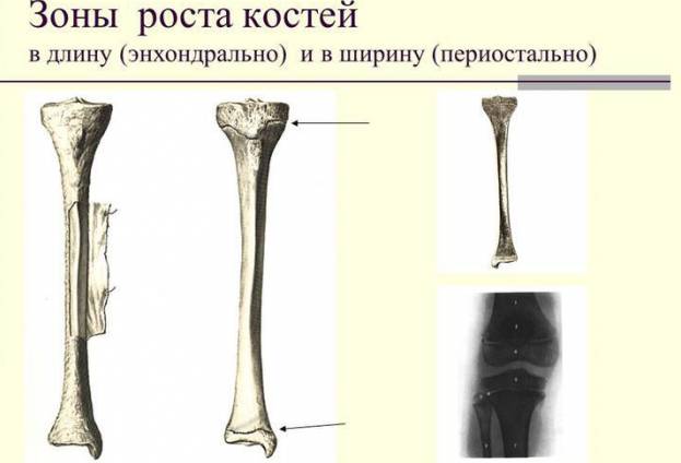 Гидрокортизона ацетат суспензия инструкция по применению