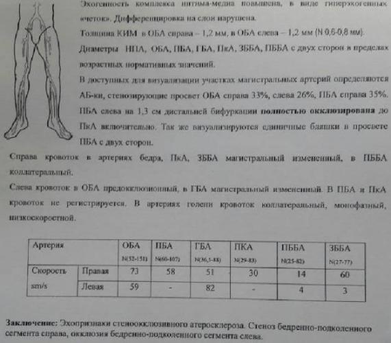 Стенозы сонных артерий и современные методы их лечения