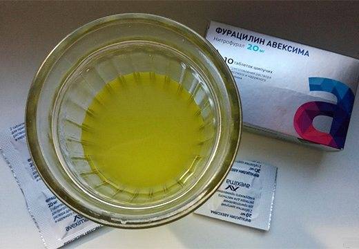 Обзор 5 лучших средств для полосканий при зубной боли: правила и рецепты