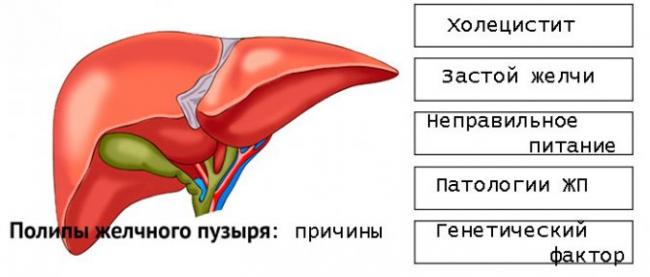 Дискинезия желчевыводящих путей и желчного пузыря – причины, типы (гипотоническая, гипертоническая), симптомы, диагностика и лечение (препараты, диета). причины, диагностика и лечение дискинезии у детей