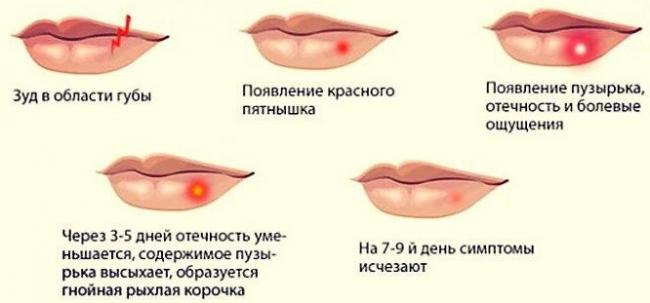 Мазь глазная "тетрациклин" отзывы