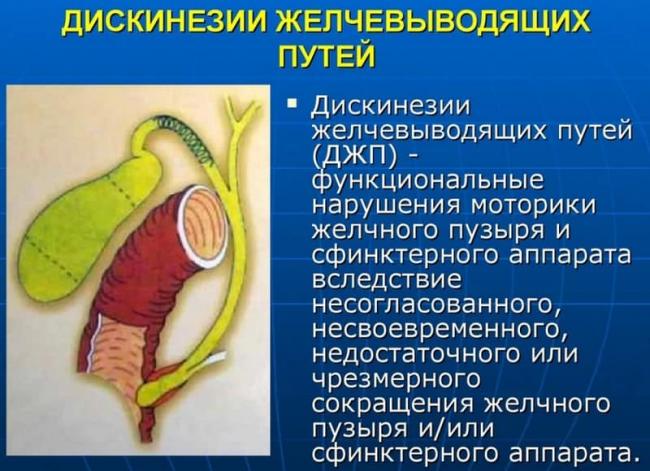 Как лечить и предупредить дискинезию желчевыводящих путей у детей
