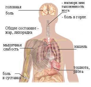 Грипп и орви сравнение таблица