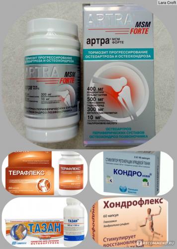 Таблетки от артроза – что нужно для лечения остеоартроза