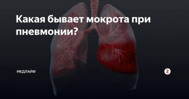 Желтая мокрота при кашле: причины появления. способы лечения