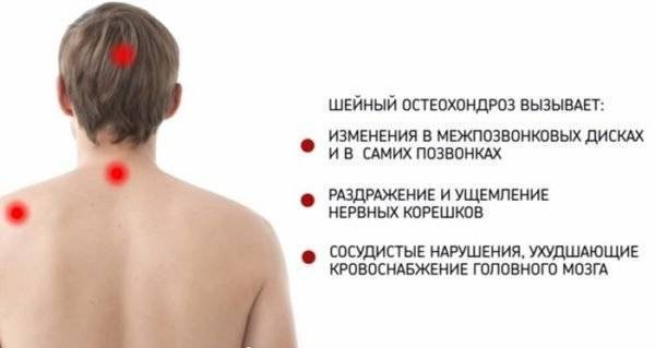 За что отвечает каждый позвонок шейного отдела позвоночника
