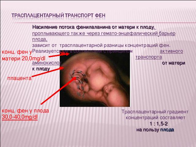 Фенилкетонурия (фку). причины, симптомы, диагностика и лечение фенилкетонурии. лечение фенилкетонурии: диета и питание.