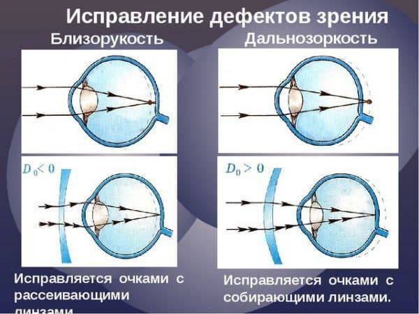 Первый раз надевать цветные линзы, как это делать: как правильно - проверка дефектов, техника, хранение, со скольки носить, для чувствительных глаз