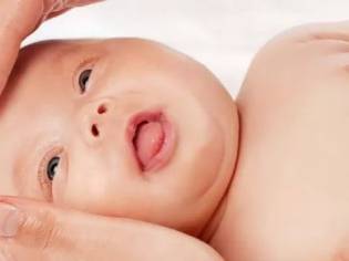 Как мы вылечили непроходимость слезного канала (дакриоцистит) без зондирования