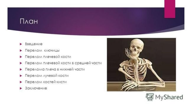 Ушиб лучевой кости руки симптомы