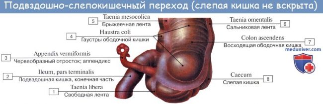 Особенности течения острого аппендицита при атипичном расположении червеобразного отростка