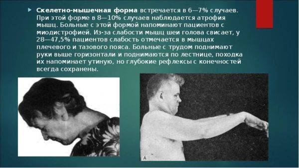 Постизометрическая релаксация мышц: упражнения для правильного положения всех отделов позвоночника