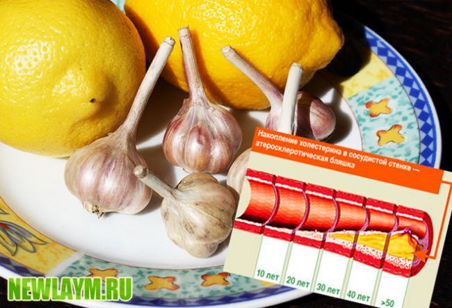 6 правил питания для здоровых сосудов и обзор продуктов для их укрепления и очищения