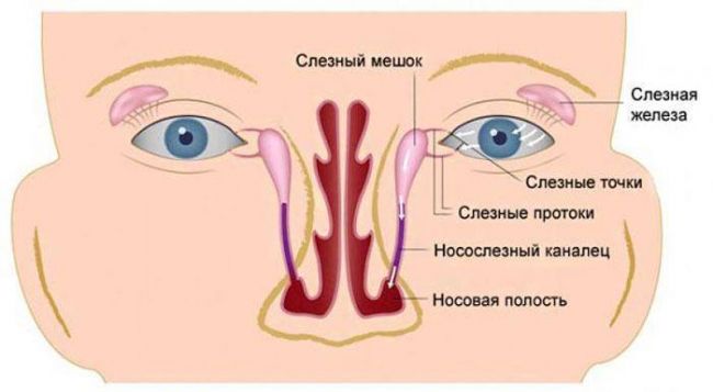 Как мы вылечили непроходимость слезного канала (дакриоцистит) без зондирования