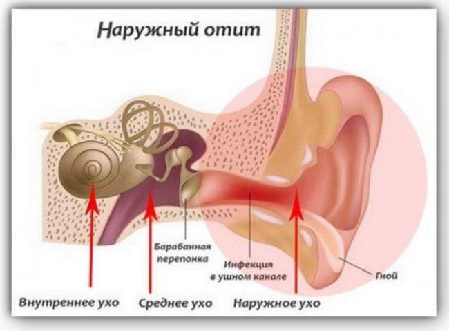 Как долго лечится отит?