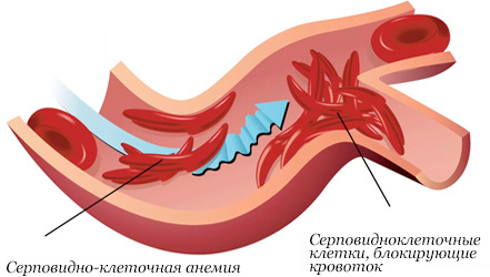 Правильное питание при глистах