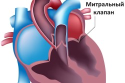 Пролапс тазовых органов у женщин: ой, что-то упало