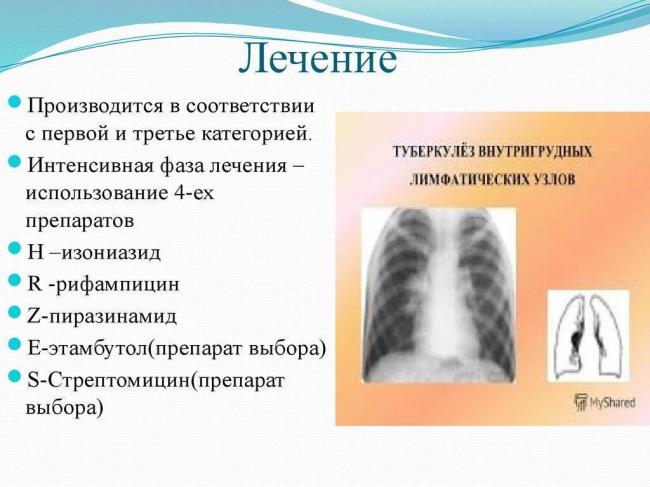 Туберкулез лимфоузлов: первые признаки и методы лечения