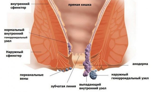 Солкосерил