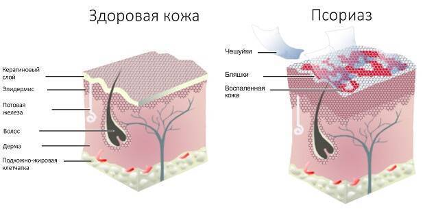Красные чешущиеся пятна на теле