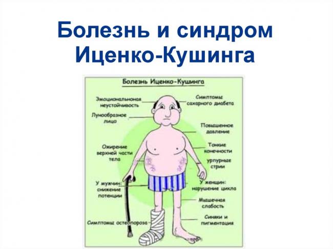 Синдром кушинга: симптомы, признаки, прогноз — онлайн-диагностика