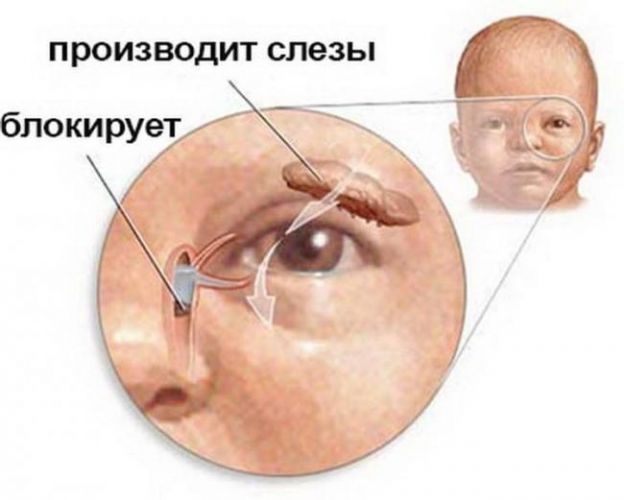 Гноятся глаза у ребенка чем лечить народными средствами