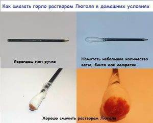 Раствор люголя с глицерином инструкция по применению