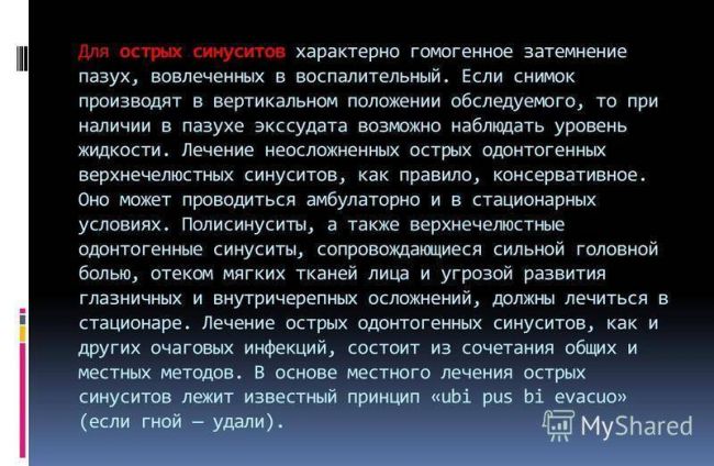 Симптомы и лечение одонтогенного синусита