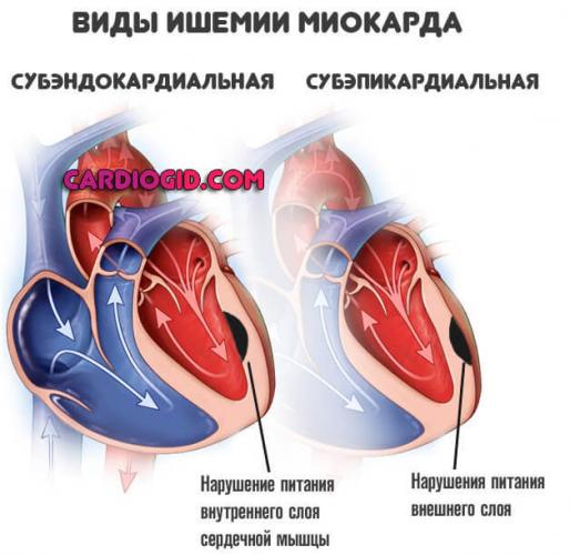 Валокордин – инструкция по применению капель, цена, отзывы, аналоги