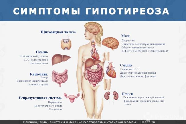 Гипотиреоз щитовидной железы симптомы и лечение у женщин препараты