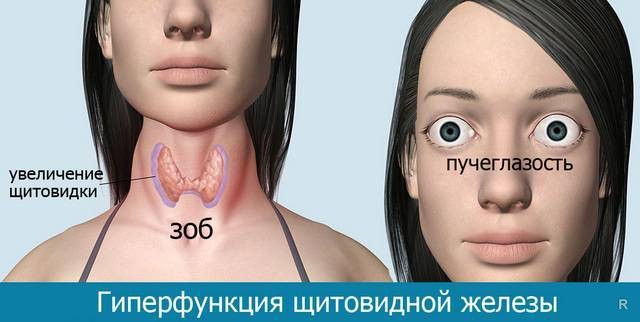 Основные заболевания щитовидной железы