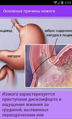 Изжога. причины, болезни при которых появляется изжога, современное лечение, изжога при беременности :: polismed.com