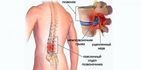 Ксефокам отзывы
