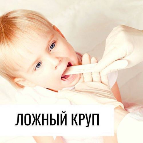 Ложный круп у детей: симптомы, лечение и первая помощь в домашних условиях