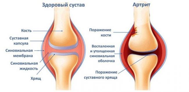 Препарат дона