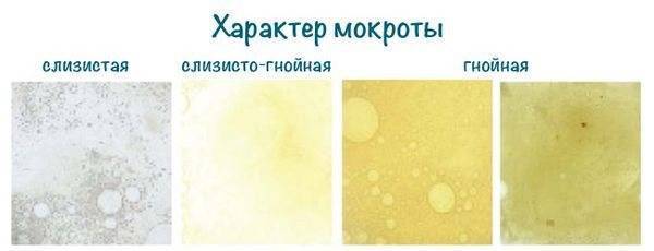 Что означает появление зеленой мокроты при кашле у взрослых и детей?
