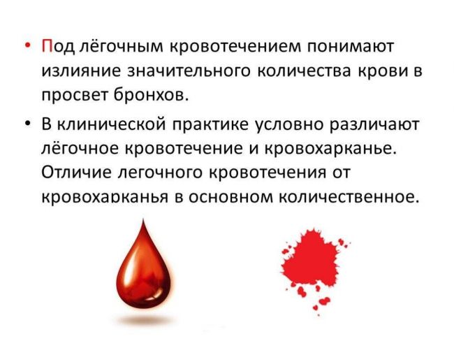 Кровохарканье при пневмонии: причины и даигностика