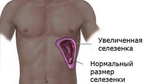 Болит спина: что делать?