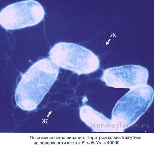 К каким последствиям в организме приводит появление кишечной палочки e. coli в моче