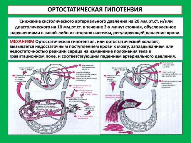 Ропинирол (мнн)