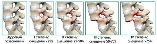 Сколько отделов в позвоночнике человека сколько костей