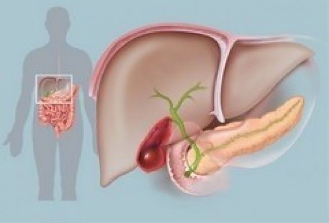 Острый холецистит – симптомы, диагностика, лечение, диета, осложнения
